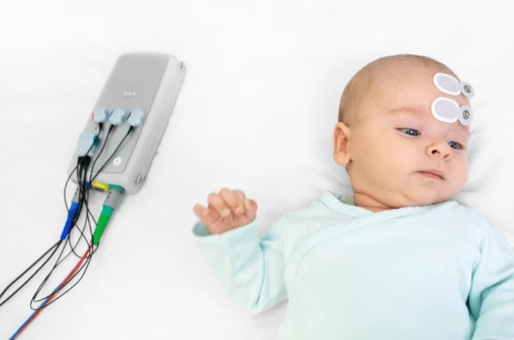 BERA (Brainstem Evoked Response Audiometry)