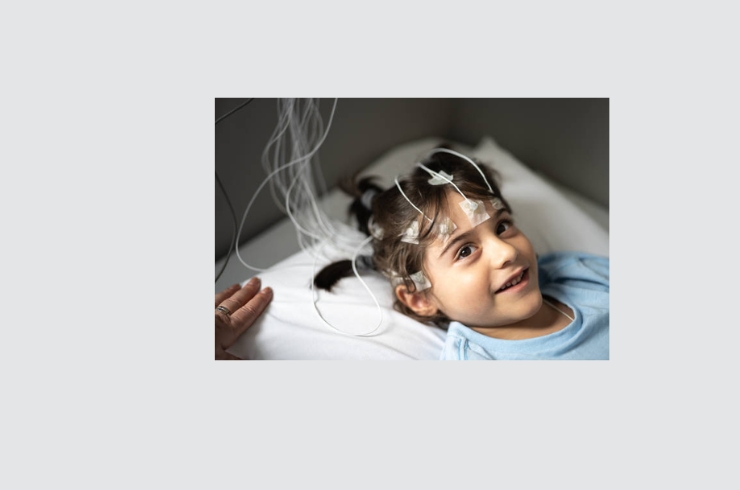 EEG (Electroencephalogram)